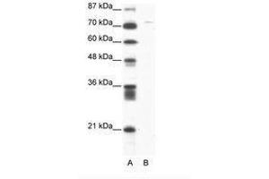 Image no. 1 for anti-Aspartate beta-Hydroxylase (ASPH) (AA 312-361) antibody (ABIN202902) (Aspartate beta Hydroxylase 抗体  (AA 312-361))