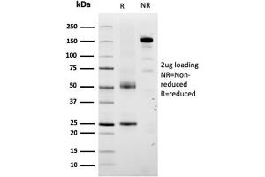 SDS-PAGE Analysis Purified TYRP1-Monospecific Mouse Monoclonal Antibody (TYRP1/3280). (Tyrosinase-Related Protein 1 抗体  (AA 257-377))