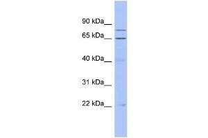 WB Suggested Anti-ZNF431 Antibody Titration:  0. (ZNF431 抗体  (Middle Region))