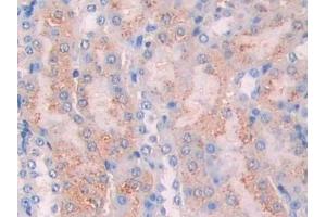 Immunohistochemistry (IHC) image for anti-Carbonic Anhydrase VII (CA7) (AA 58-217) antibody (ABIN7437332)