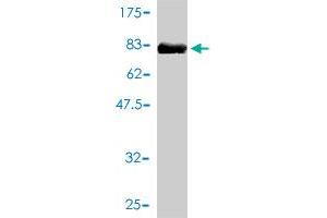 Western Blot detection against Immunogen (72. (IL11RA 抗体  (AA 1-422))