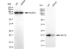 Western blotting analysis using RAP1B antibody (ABIN7800134).