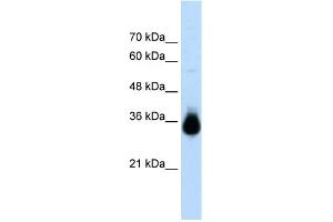 WB Suggested Anti-HOXC9 Antibody Titration:  2. (HOXC9 抗体  (N-Term))