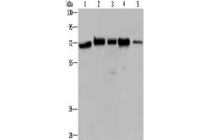 Gel: 8 % SDS-PAGE, Lysate: 40 μg, Lane 1-5: A172 cells, Hela cells, 293T cells, K562 cells, human testis tissue, Primary antibody: ABIN7128290(AGFG1 Antibody) at dilution 1/727, Secondary antibody: Goat anti rabbit IgG at 1/8000 dilution, Exposure time: 40 seconds (AGFG1 抗体)