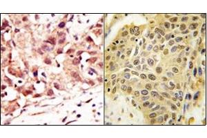 Image no. 2 for anti-SUMO1/sentrin Specific Peptidase 5 (SENP5) (C-Term) antibody (ABIN356757) (SENP5 抗体  (C-Term))