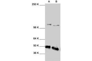 Western Blot analysis of NFKB1 polyclonal antibody  expression in HeLa (A) and HL-60 (B) whole cell lysates. (NFKB1 抗体  (C-Term))