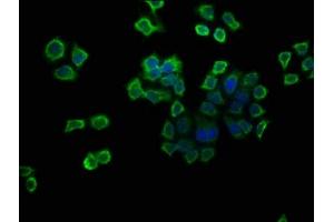 Immunofluorescence staining of PC-3 cells with ABIN7175262 at 1:133, counter-stained with DAPI.