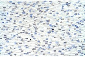 Immunohistochemistry (IHC) image for anti-Ring Finger Protein 8 (RNF8) (C-Term) antibody (ABIN2778597)