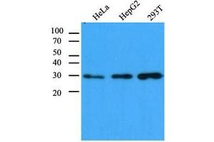 The cell lysates (40 ug) were resolved by SDS-PAGE, transferred to PVDF membrane and probed with anti-human CBR1 antibody (1:1,000). (CBR1 抗体  (AA 1-277))