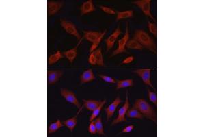 Immunofluorescence (IF) image for anti-Mitogen-Activated Protein Kinase Kinase Kinase 7 (MAP3K7) (AA 300-470) antibody (ABIN6143503)