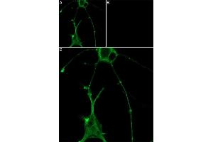 Unlabeled GsMTx-4 successfully blocks GsMTx-4-ATTO Fluor-647N binding. (GsMTx-4 peptide (Atto 647N))
