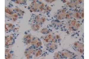 DAB staining on IHC-P; Samples: Human Stomach Tissue (SIRPB1 抗体  (AA 127-356))