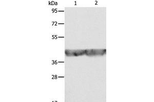 Western Blot analysis of A549 and hela cell using ALDOA Polyclonal Antibody at dilution of 1:500 (ALDOA 抗体)