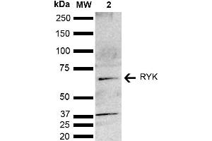 Western blot analysis of Mouse brain lysate showing detection of ~67. (RYK 抗体  (AA 150-250) (Biotin))