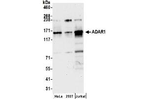 anti-Adenosine Deaminase, RNA-Specific (ADAR) (AA 200-250) antibody