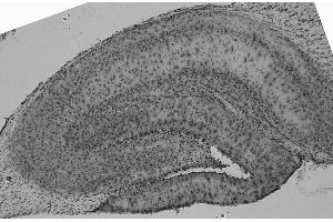 Adult rat hippocampus immunohistochemistry (high and low magnification). (QKI 抗体  (pan))