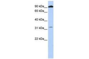 Image no. 1 for anti-Glutamate Receptor, Metabotropic 6 (GRM6) (AA 36-85) antibody (ABIN6741410) (Metabotropic Glutamate Receptor 6 抗体  (AA 36-85))