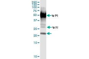 Immunoprecipitation of GLO1 transfected lysate using anti-GLO1 MaxPab rabbit polyclonal antibody and Protein A Magnetic Bead , and immunoblotted with GLO1 MaxPab rabbit polyclonal antibody (D01) . (GLO1 抗体  (AA 1-184))