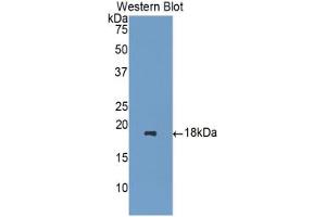 Western blot analysis of the recombinant protein. (HPSE 抗体  (AA 400-543))