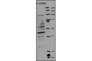 Western blot analysis of anti-RFC5 Antibody (Center ) (ABIN389314 and ABIN2839435) in rat SMC cell line lysates (35 μg/lane). (RFC5 抗体  (AA 170-200))