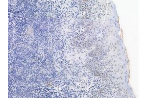 ABIN6255562 and ABIN6267432 at 1/100 staining human normal tonsil tissue by IHC-P.