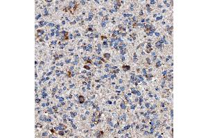 IHC analysis of RAB7/RAB7A using anti-RAB7/RAB7A antibody (ABIN7600597). (RAB7A 抗体  (AA 21-177))
