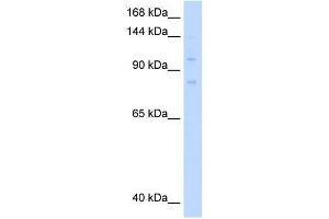 MCM8 antibody used at 0. (MCM8 抗体  (C-Term))