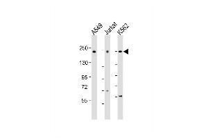 Western Blot at 1:2000 dilution Lane 1: A549 whole cell lysate Lane 2: Jurkat whole cell lysate Lane 3: K562 whole cell lysate Lysates/proteins at 20 ug per lane. (PSME4 抗体  (AA 503-535))