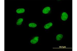 Immunofluorescence of purified MaxPab antibody to CDK7 on HeLa cell. (CDK7 抗体  (AA 1-346))