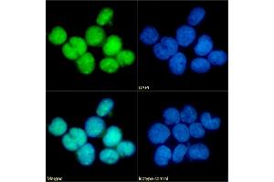 Immunofluorescence staining of fixed U937 cells with anti-CCR5 (phosphoserine 349) antibody E11/19. (Recombinant CCR5 抗体  (pSer349))