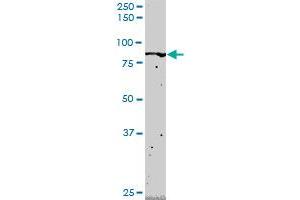 FLI1 monoclonal antibody (M02), clone 2G8. (FLI1 抗体  (AA 1-452))