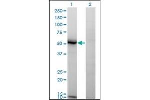 Western Blotting (WB) image for anti-N-Acylsphingosine Amidohydrolase (Acid Ceramidase) 1 (ASAH1) (AA 25-125) antibody (ABIN782337) (ASAH1 抗体  (AA 25-125))