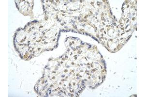 Rabbit Anti-PPARD antibody        Paraffin Embedded Tissue:  Human Placenta cell   Cellular Data:  Epithelial cells of renal tubule  Antibody Concentration:   4.