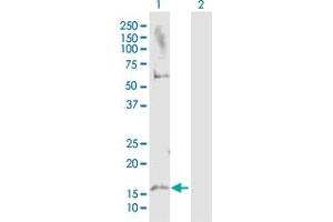Western Blot analysis of MAP1LC3A expression in transfected 293T cell line by MAP1LC3A MaxPab polyclonal antibody. (MAP1LC3A 抗体  (AA 1-121))