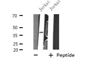 Western blot analysis of extracts from Jurkat cells, using GTF3A antibody. (GTF3A 抗体  (N-Term))