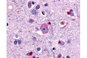 Anti-GRM1 / MGLUR1 antibody IHC of human brain, neurons and glia. (Metabotropic Glutamate Receptor 1 抗体  (N-Term))