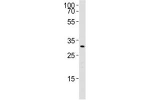 Western blot analysis of lysate from rat liver using Cebpb antibody. (CEBPB 抗体  (AA 99-131))