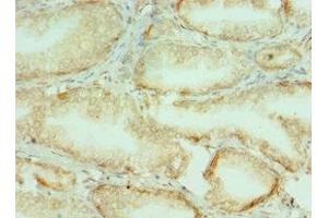Immunohistochemistry of paraffin-embedded human prostate tissue using ABIN7148221 at dilution of 1:100 (COL1A1 抗体  (AA 521-680))
