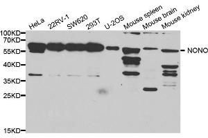 Western blot analysis of extracts of various cell lines, using Nono antibody. (NONO 抗体)