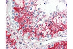 Anti-LHCGR / LHR / LH Receptor antibody IHC staining of human testis. (LHCGR 抗体  (AA 622-699))