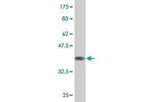 Western Blot detection against Immunogen (37. (NCOA4 抗体  (AA 505-614))