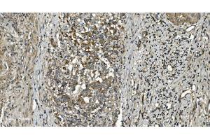 IHC analysis of RGS6 using anti-RGS6 antibody (ABIN7602326).