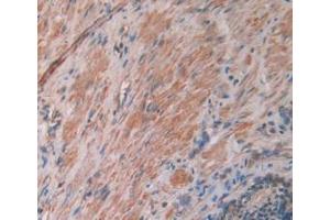 DAB staining on IHC-P; Samples: Human Prostate Gland Tissue (IL12A 抗体  (AA 23-219))