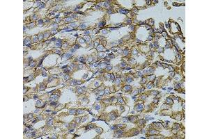 Immunohistochemistry of paraffin-embedded Mouse stomach using TRMT2A Polyclonal Antibody at dilution of 1:100 (40x lens). (TRMT2A 抗体)