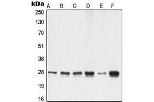 Western blot analysis of 14-3-3 gamma expression in A549 (A), A431 (B), K562 (C), NIH3T3 (D), PC12 (E), rat liver (F) whole cell lysates. (14-3-3 gamma 抗体  (Center))