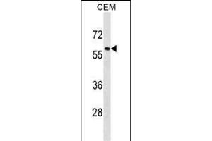 TRIM58 Antibody (C-term) (ABIN1537364 and ABIN2850371) western blot analysis in CEM cell line lysates (35 μg/lane). (TRIM58 抗体  (C-Term))