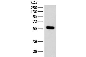 Western blot analysis of Mouse pancreas tissue lysate using IPPK Polyclonal Antibody at dilution of 1:350 (IPPK 抗体)