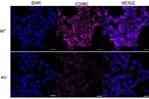 Immunocytochemical staining of HeLa cells using COX6C antibody (ABIN7798249), 1:1,000), Top panel: wild-type (WT), Bottom panal: COX6C shRNA knockdown (KD).