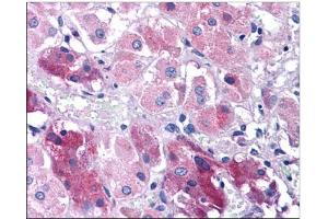 Human Adrenal: Formalin-Fixed, Paraffin-Embedded (FFPE) (TNIP3 抗体  (C-Term))