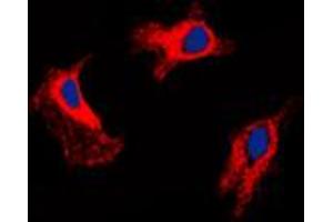 Immunofluorescent analysis of MMP9 staining in HuvEc cells. (MMP 9 抗体  (C-Term))